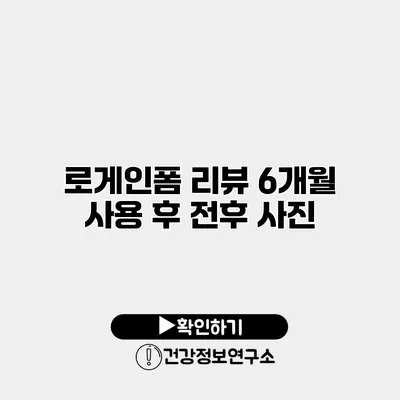 로게인폼 리뷰 6개월 사용 후 전후 사진