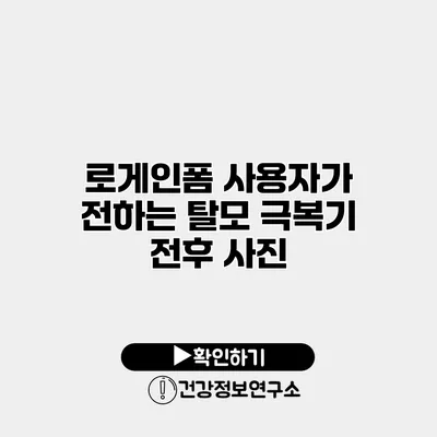 로게인폼 사용자가 전하는 탈모 극복기 전후 사진