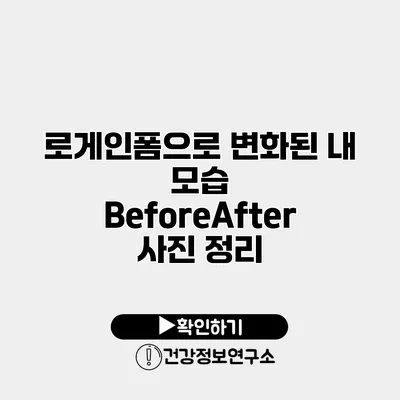 로게인폼으로 변화된 내 모습 Before/After 사진 정리